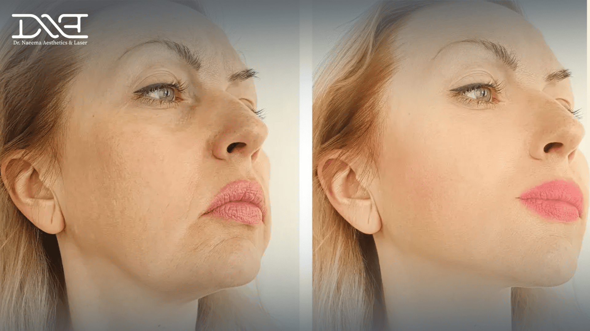 Laser Aesthetics Treatment: What to Expect and How to Prepare